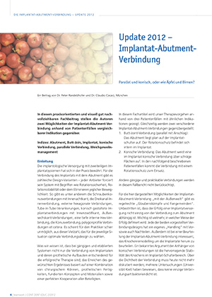 Update 2012 – Implantat-Abutment-Verbindung – Parallel und konisch, oder wie Äpfel und Birnen?