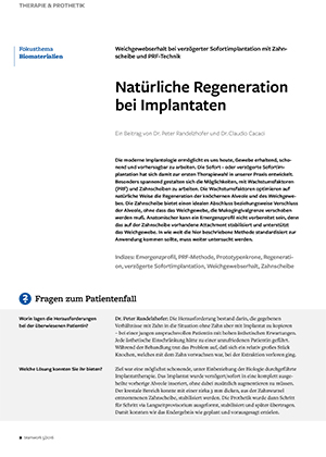 Moderne implantatprothetische Lösungen. Einfach wie komplex, vielleicht traditionell – aber vor allem erfolgreich.