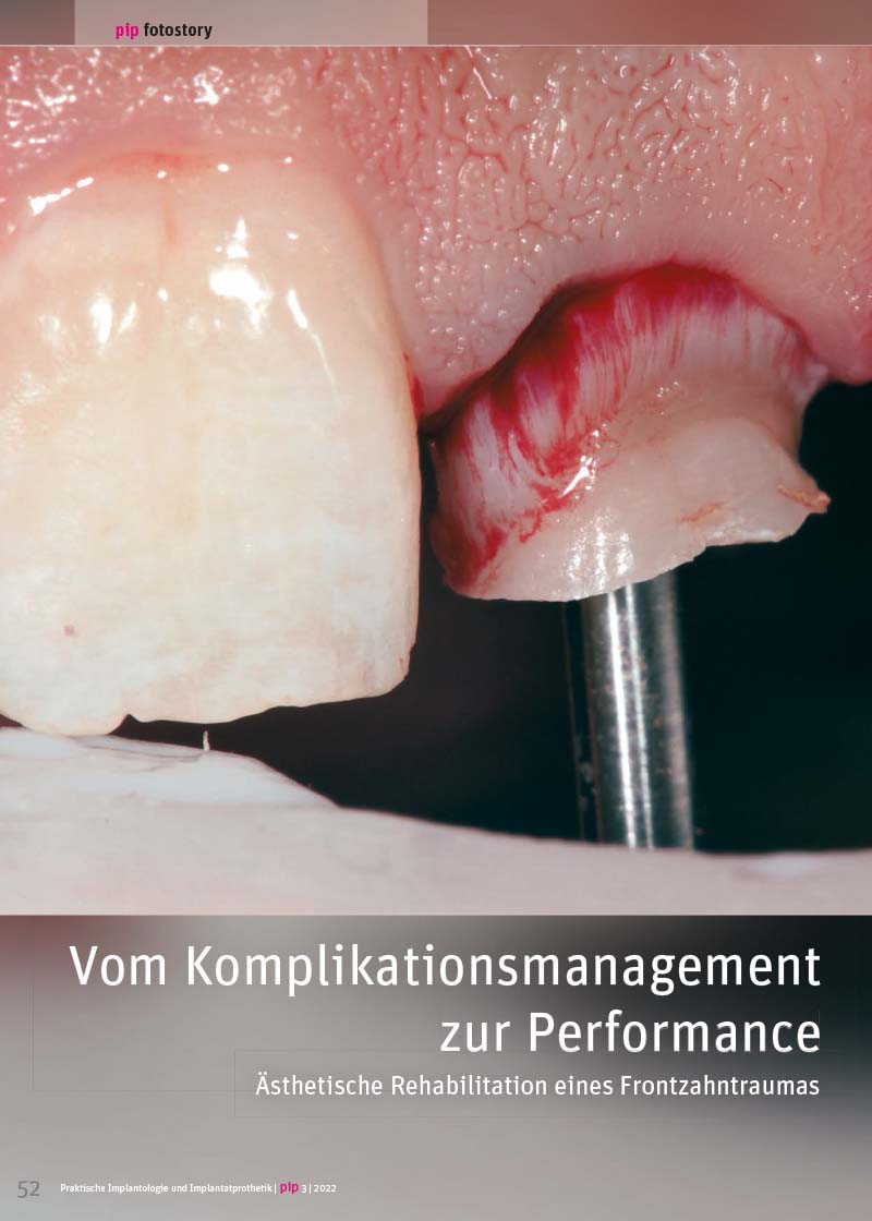 Vom Komplikationsmanagement zur Performance